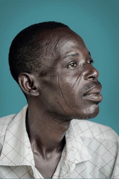 A portrait black man with a scarred face looks pensively to the right. He sits against a teal background, wearing a gridded white collared shirt.