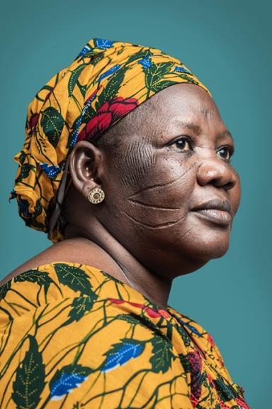 A black woman with a scarred face looks pensively to the right, as if remembering something. She is in front of a teal background, wearing a golden yellow, leaf-patterned headwrap that matches her shirt.