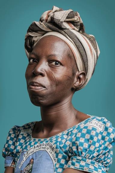 A black woman with a scarred face looks at the camera lens, as if trying to contain a laugh. She's against a teal background, wearing a striped earthy headwrap and bright teal checkered shirt that nearly matches the background.